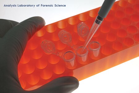 DNA個人識別費用